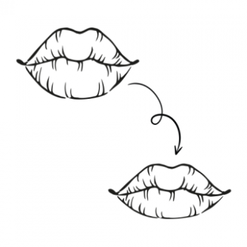 Lip fillers mislukt? Déze oplossing helpt echt