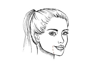 Marionetlijnen