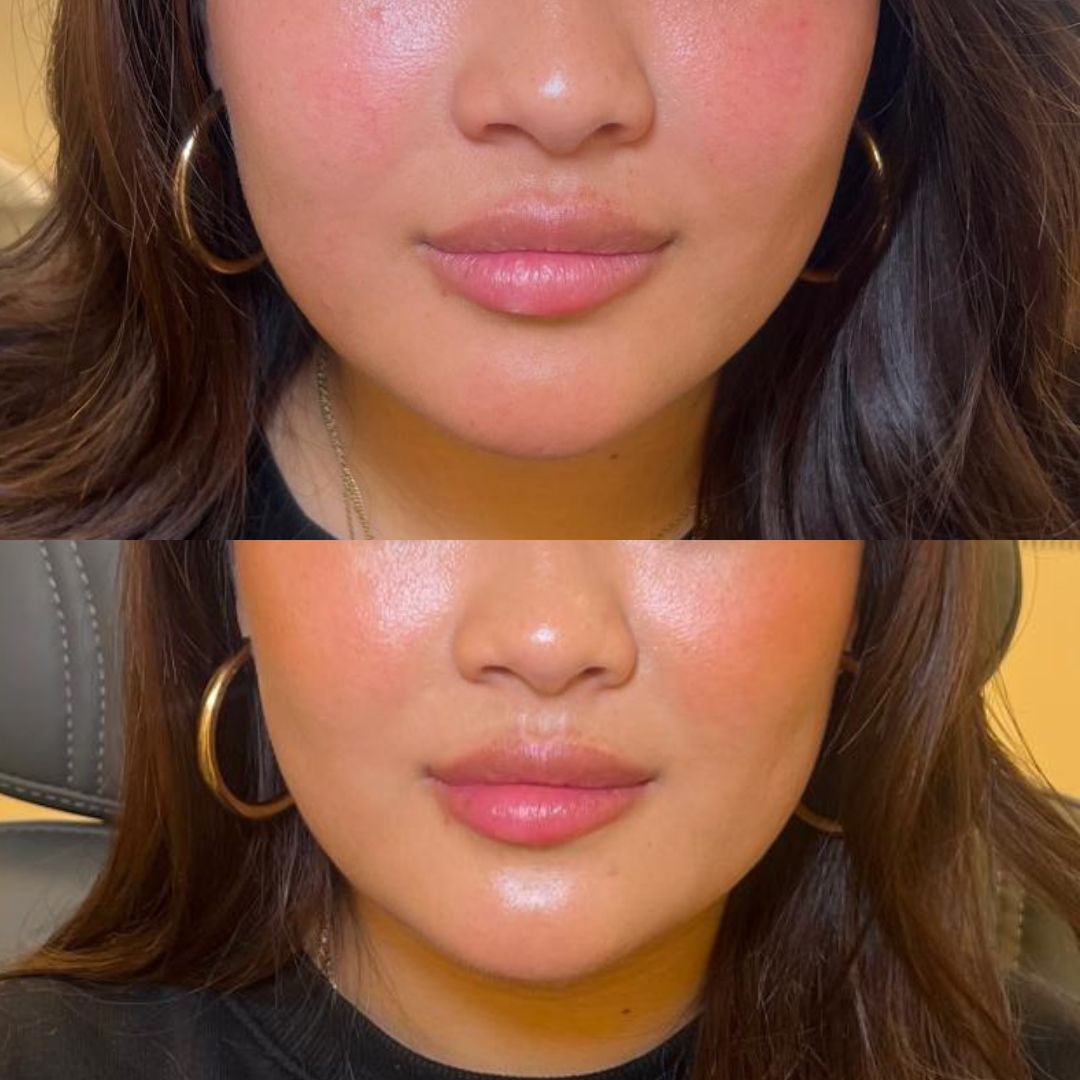 grid-img-{{ loop.index }} 