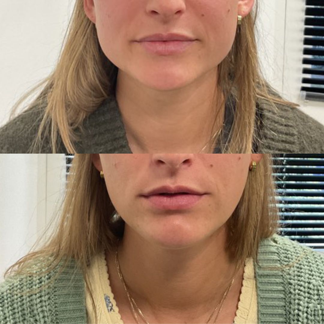 grid-img-{{ loop.index }} 