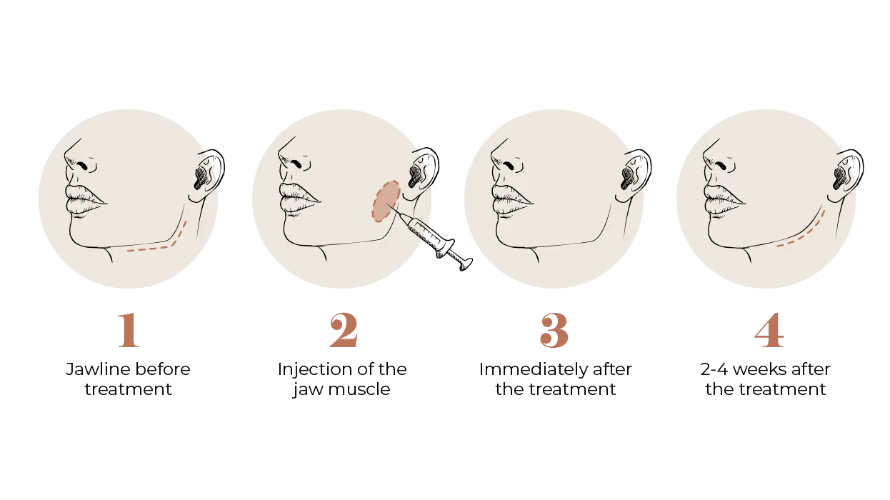 Face Slimming