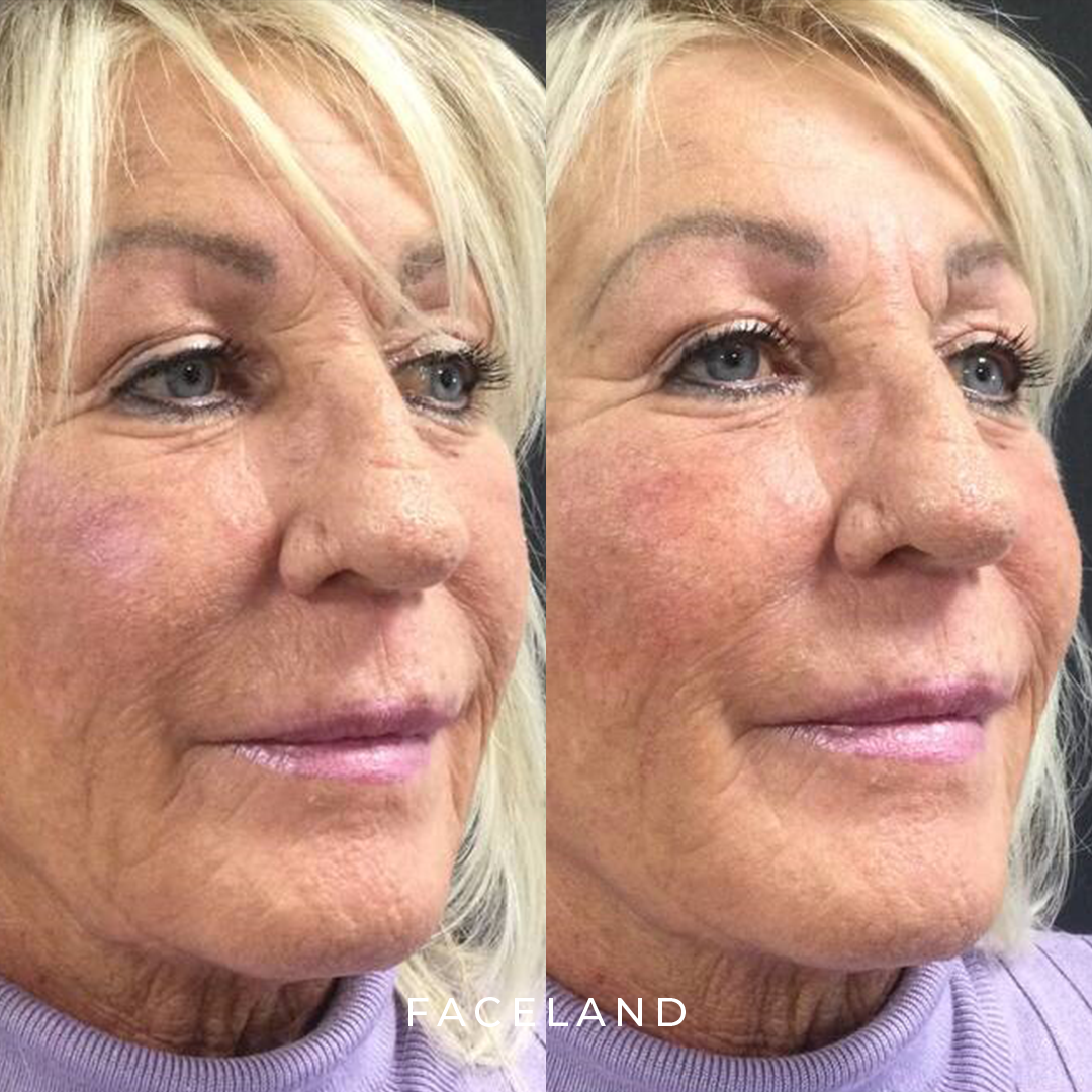 grid-img-{{ loop.index }} 