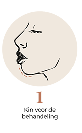 steps-img-{{ loop.index }}