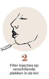 steps-img-{{ loop.index }}