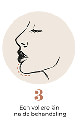 steps-img-{{ loop.index }}