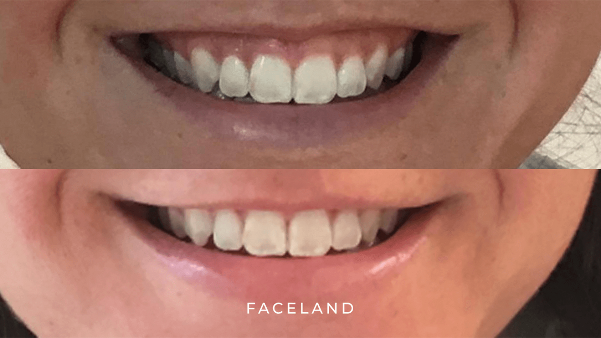 grid-img-{{ loop.index }} 