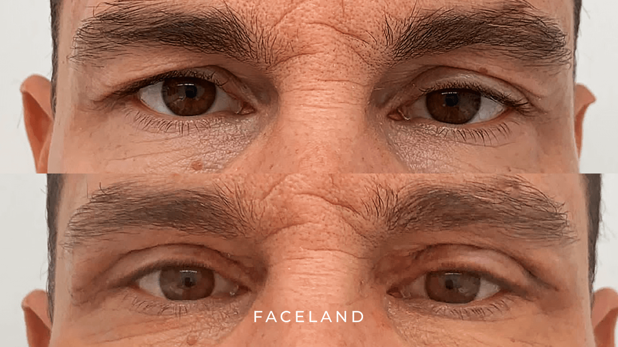 grid-img-{{ loop.index }} 