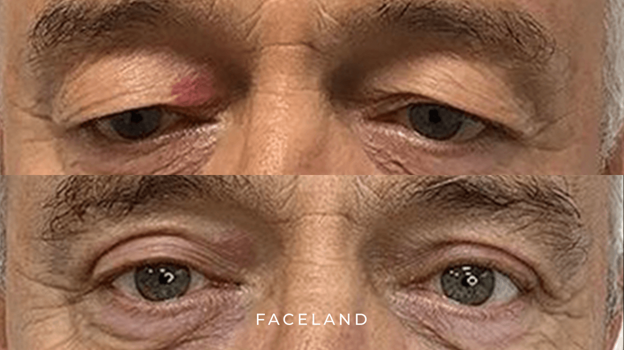 grid-img-{{ loop.index }} 