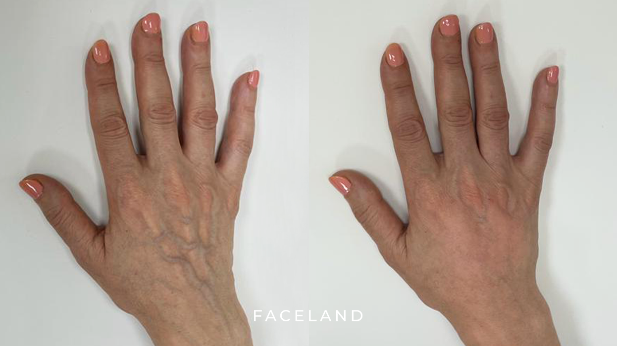 grid-img-{{ loop.index }} 