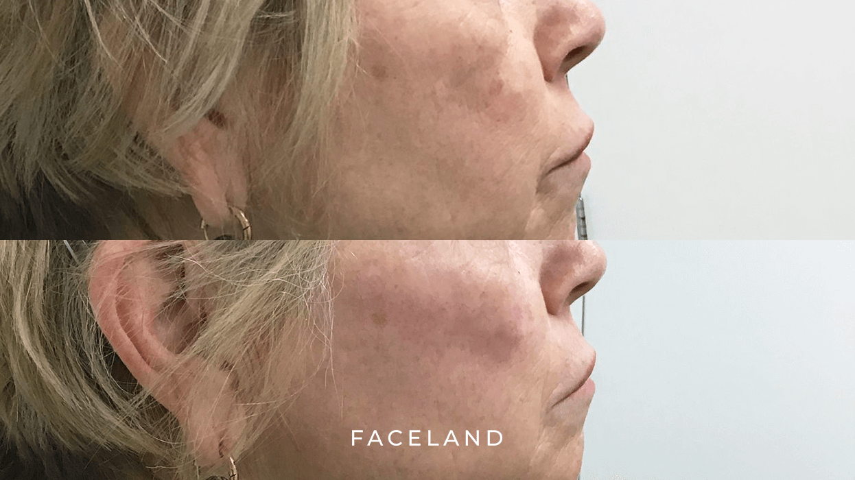 grid-img-{{ loop.index }} 