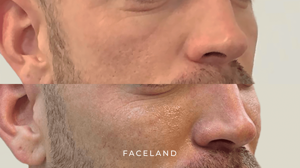 grid-img-{{ loop.index }} 