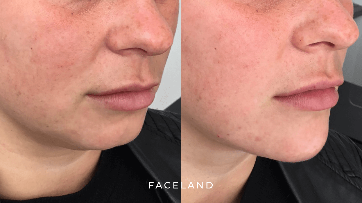 grid-img-{{ loop.index }} 