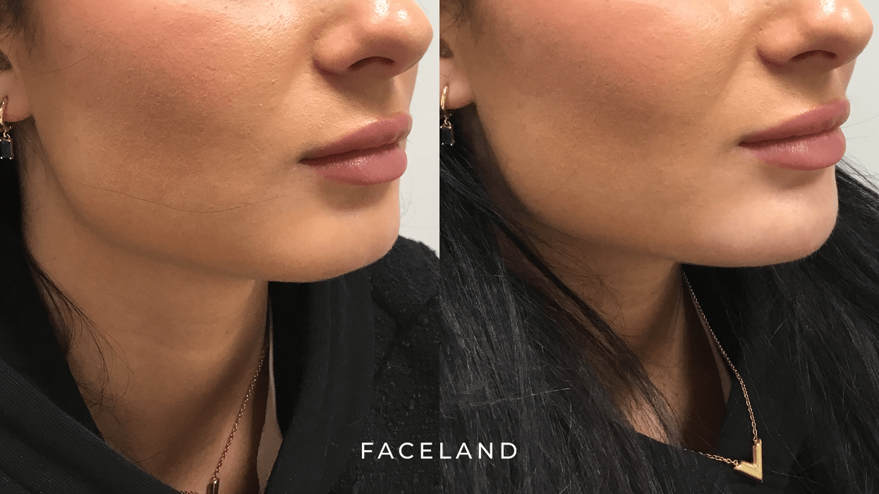 grid-img-{{ loop.index }} 