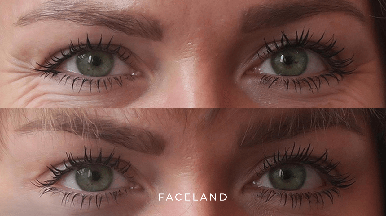 grid-img-{{ loop.index }} 