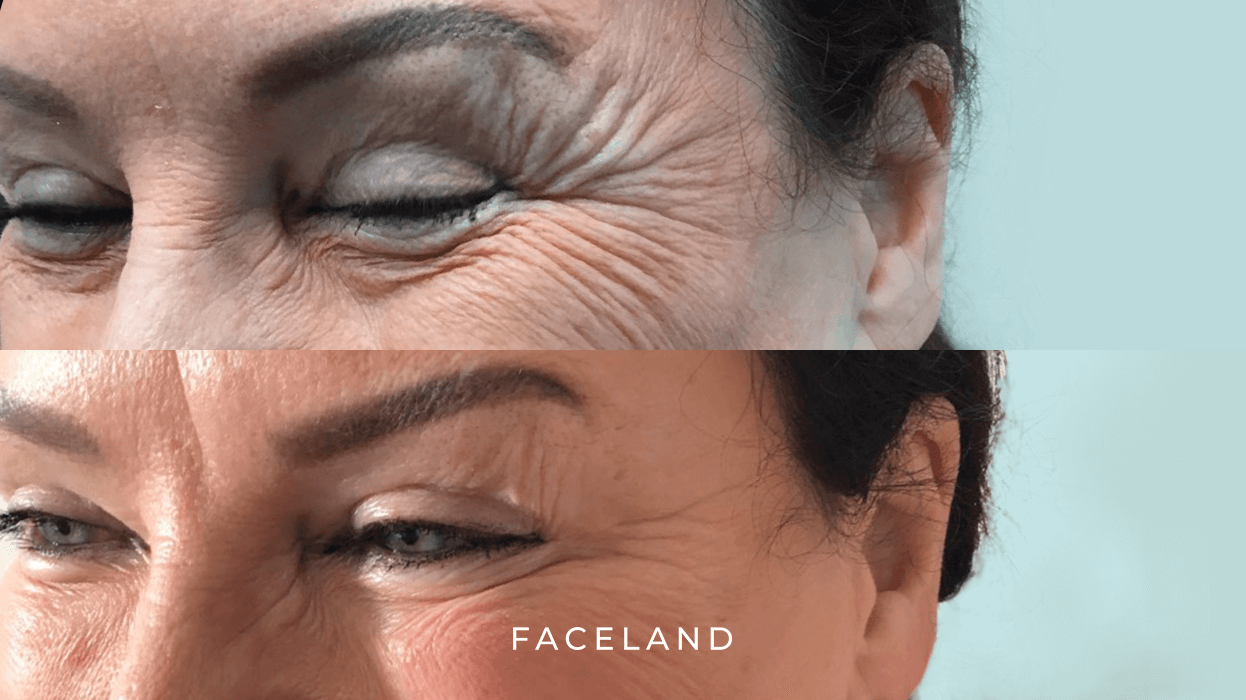 grid-img-{{ loop.index }} 