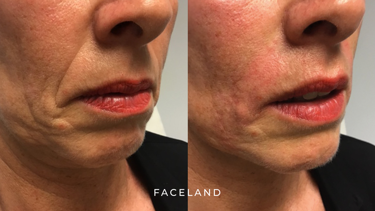 grid-img-{{ loop.index }} 