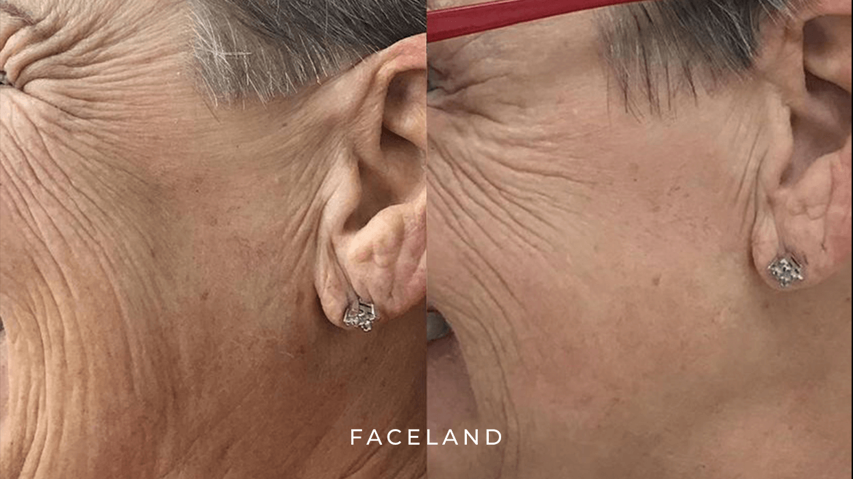 grid-img-{{ loop.index }} 