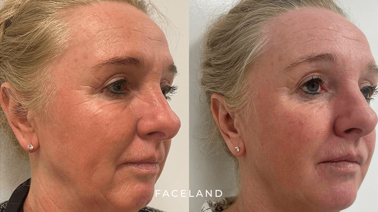 grid-img-{{ loop.index }} 