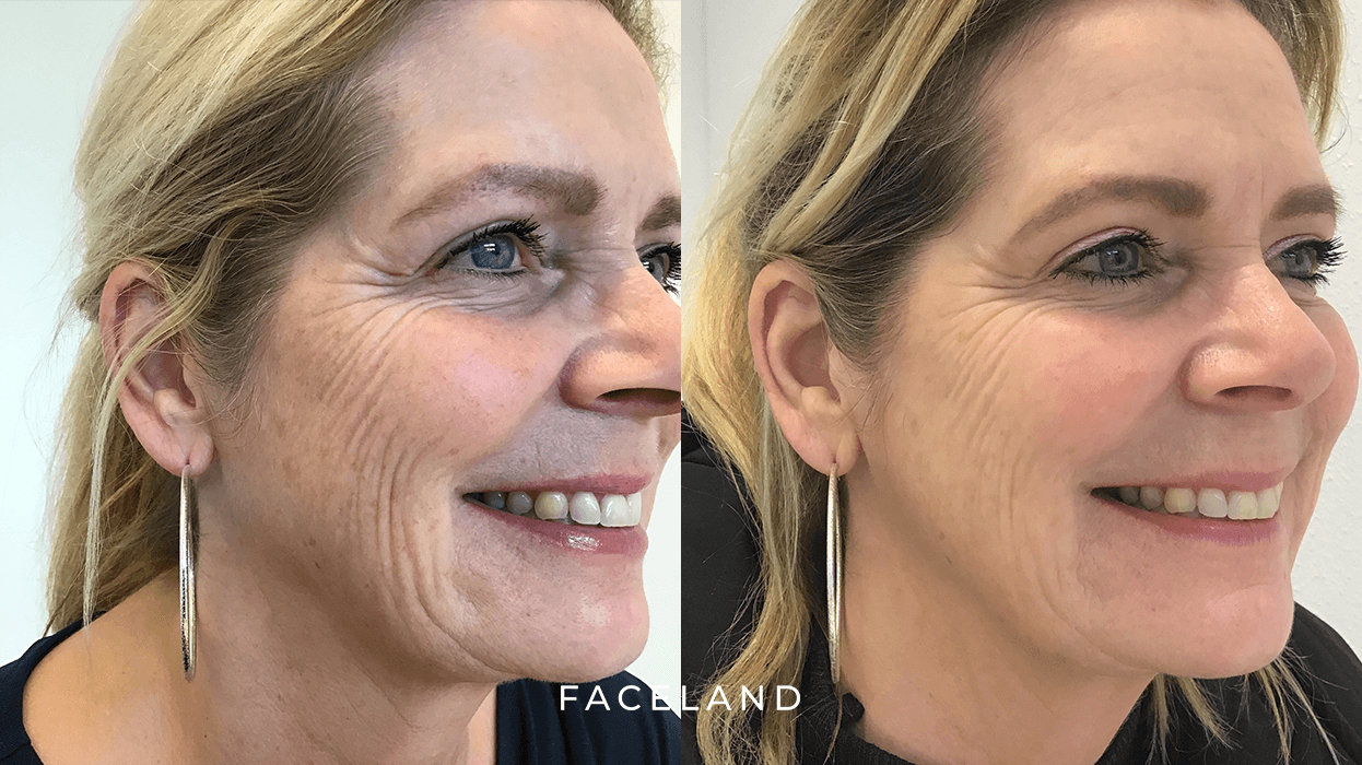 grid-img-{{ loop.index }} 