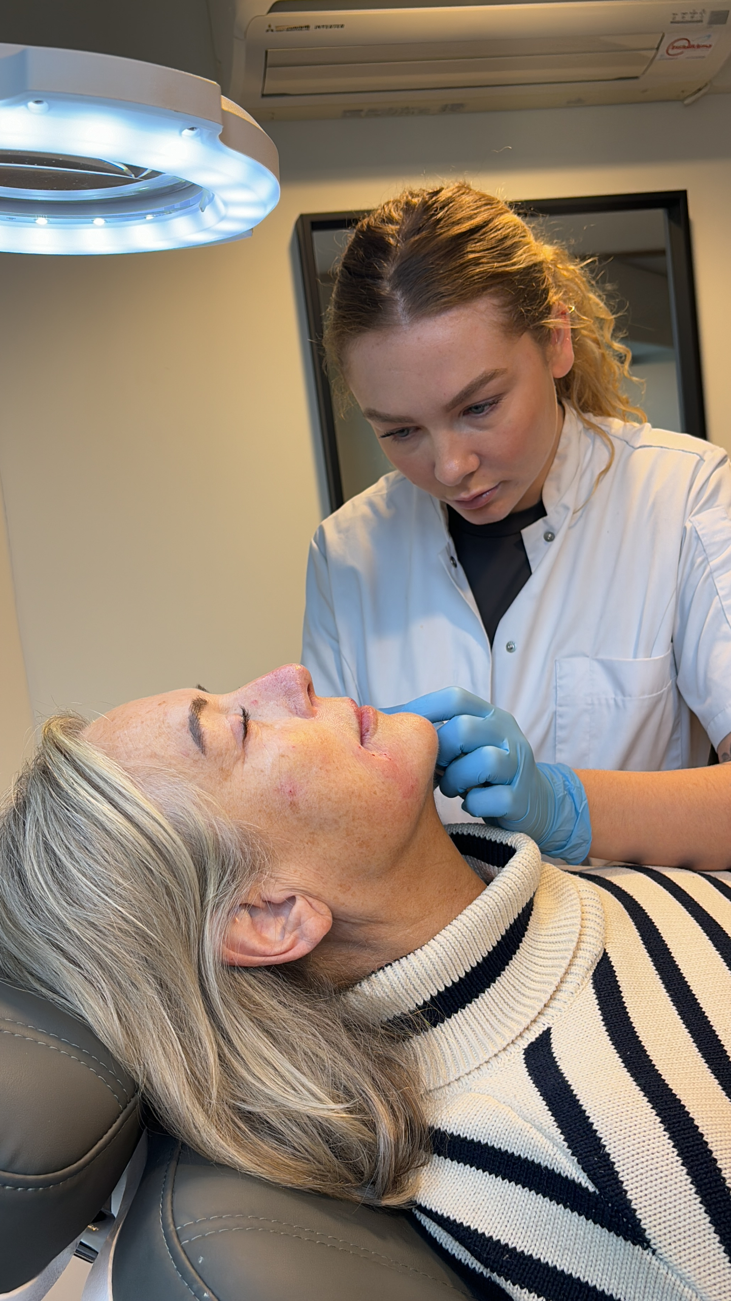 Stappenplan jukbeenderen fillers