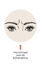 steps-img-{{ loop.index }}