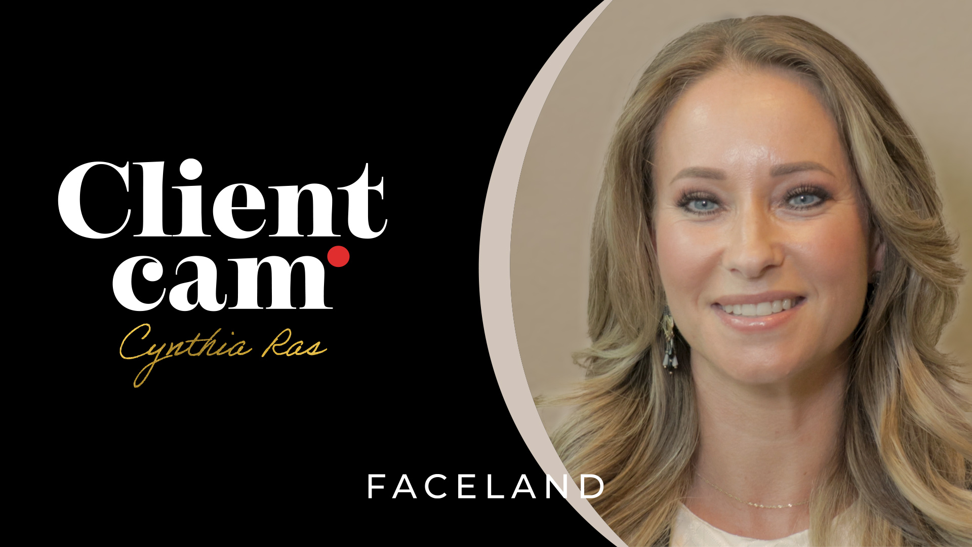 De spierontspanner fronsrimpel behandeling van Cynthia