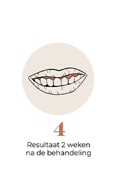 steps-img-{{ loop.index }}