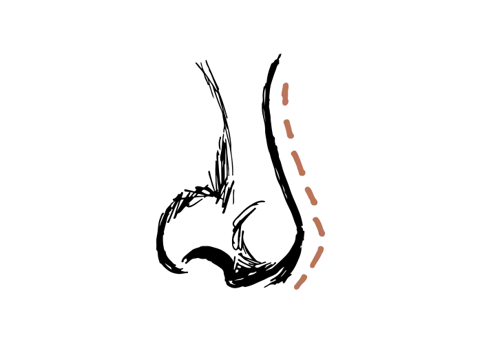 Hängende Nasenspitze