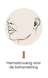 steps-img-{{ loop.index }}