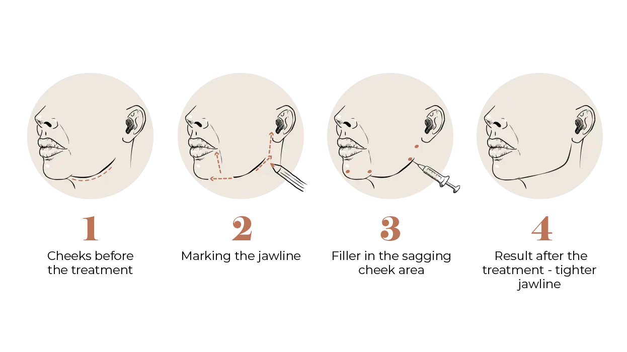Saggy Jowls