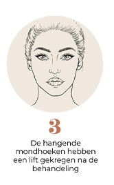 steps-img-{{ loop.index }}