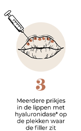 steps-img-{{ loop.index }}