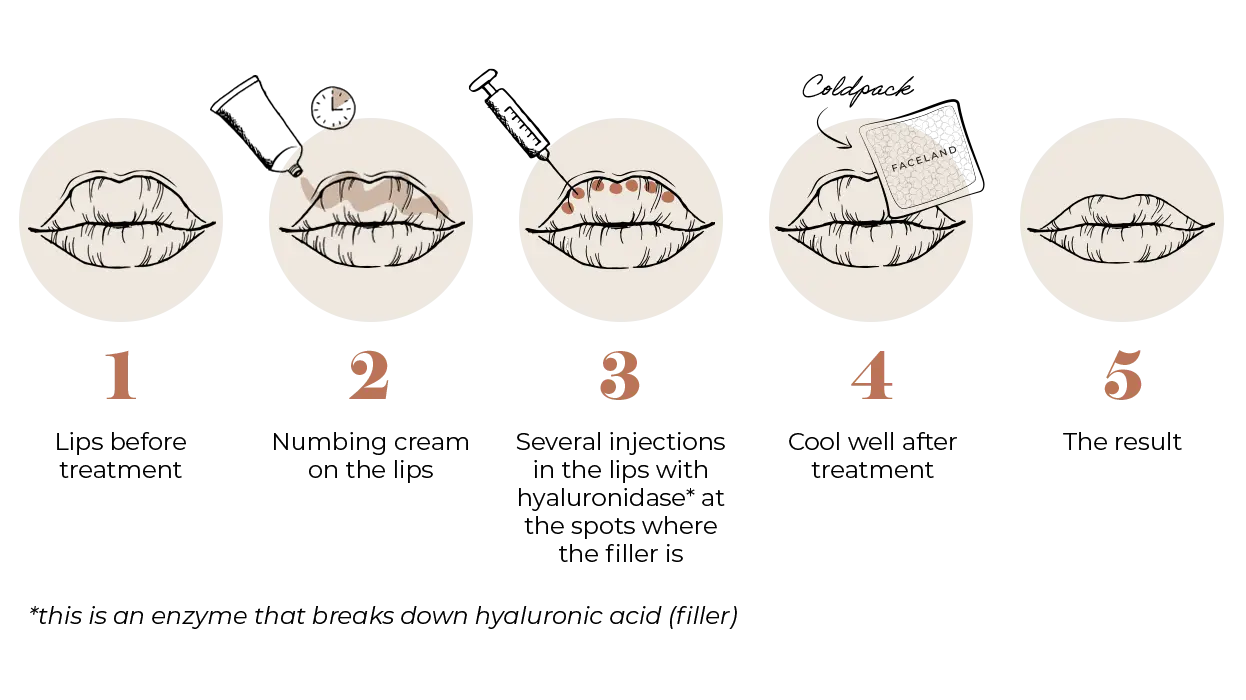 Hyalase