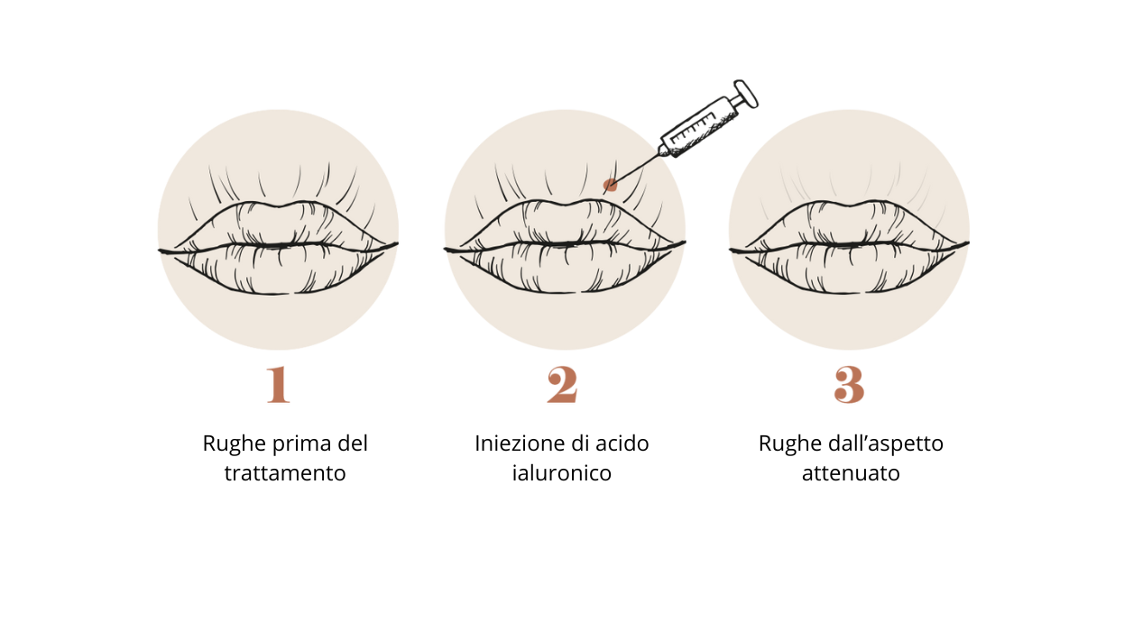 Filler codice a barre