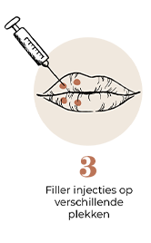 steps-img-{{ loop.index }}