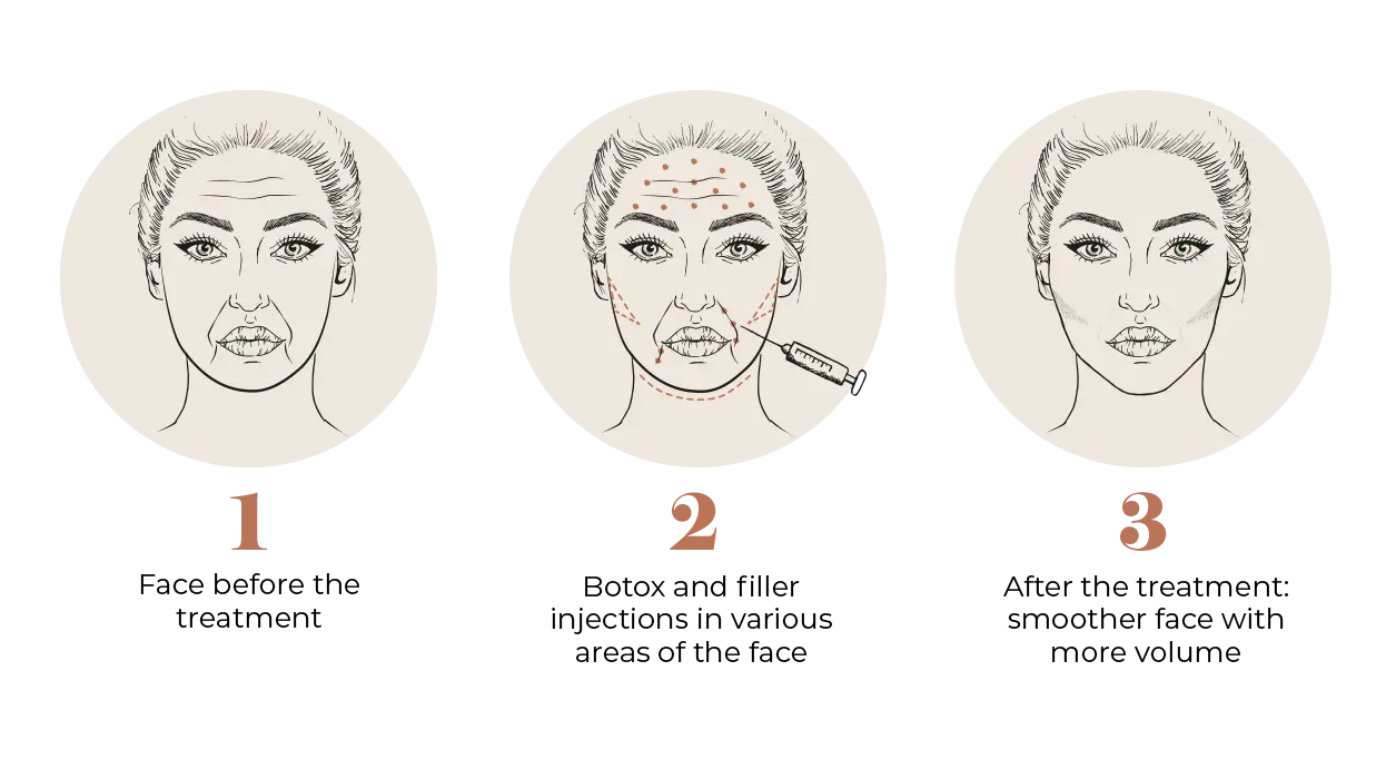 Liquid Facelift