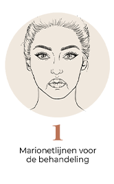 steps-img-{{ loop.index }}