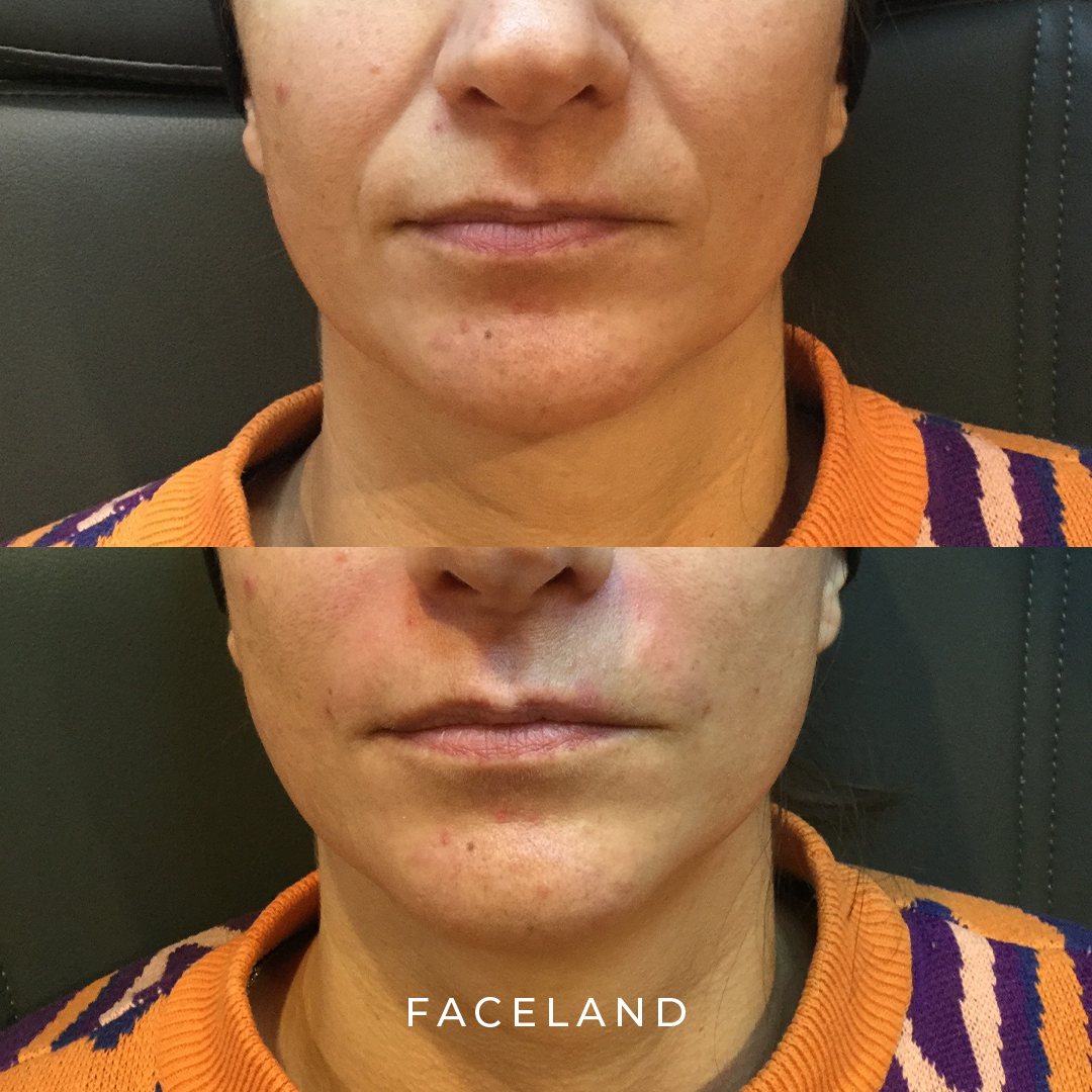 grid-img-{{ loop.index }} 