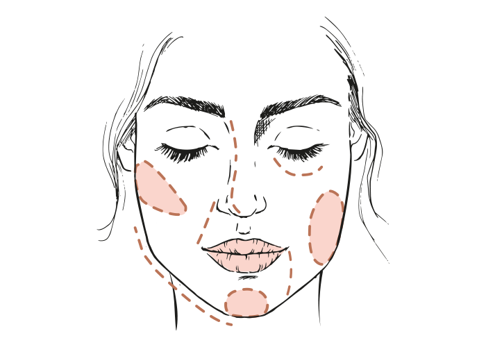 4 feiten over fillers