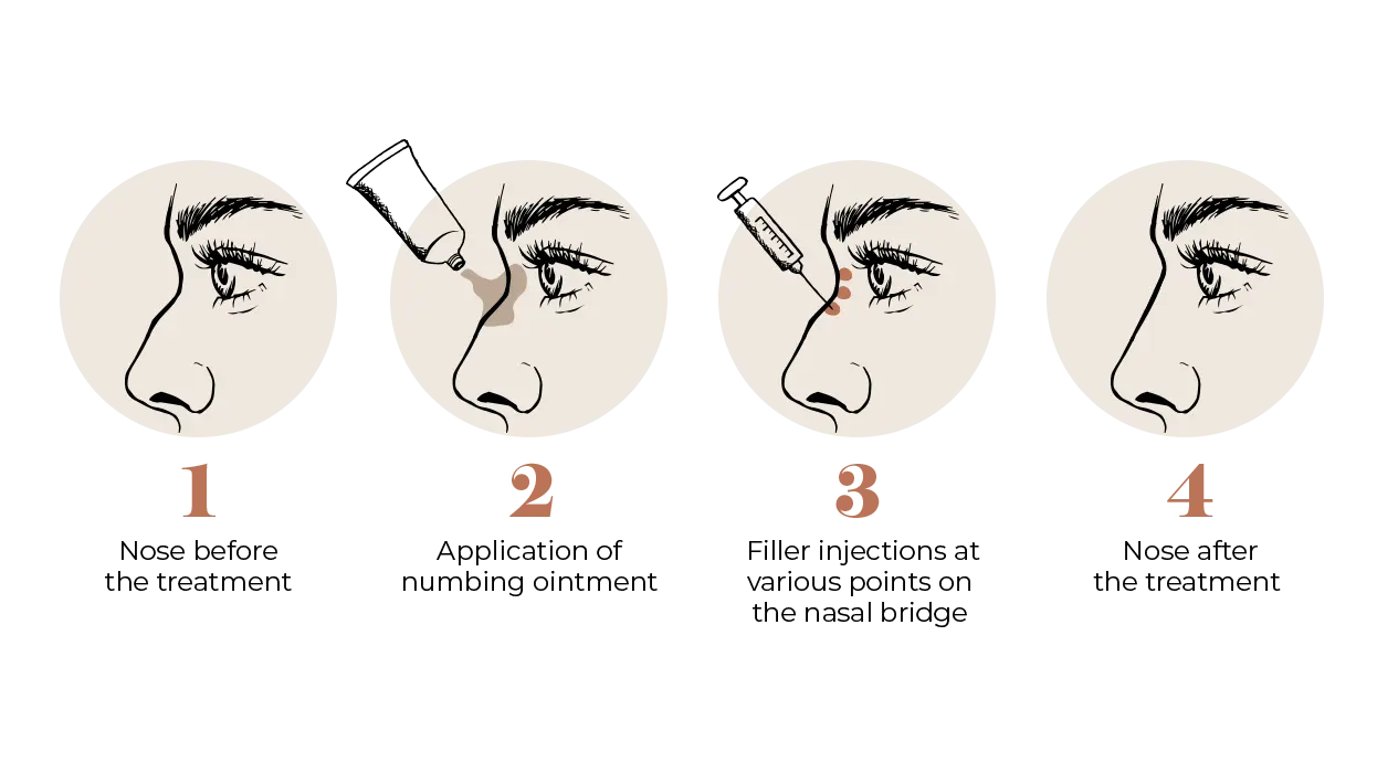 Nose Bridge