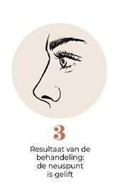 steps-img-{{ loop.index }}