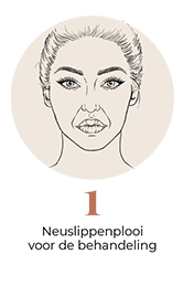 steps-img-{{ loop.index }}