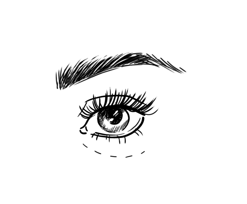 Van blauwe kringen onder ogen naar een stralende blik: zo werkt het