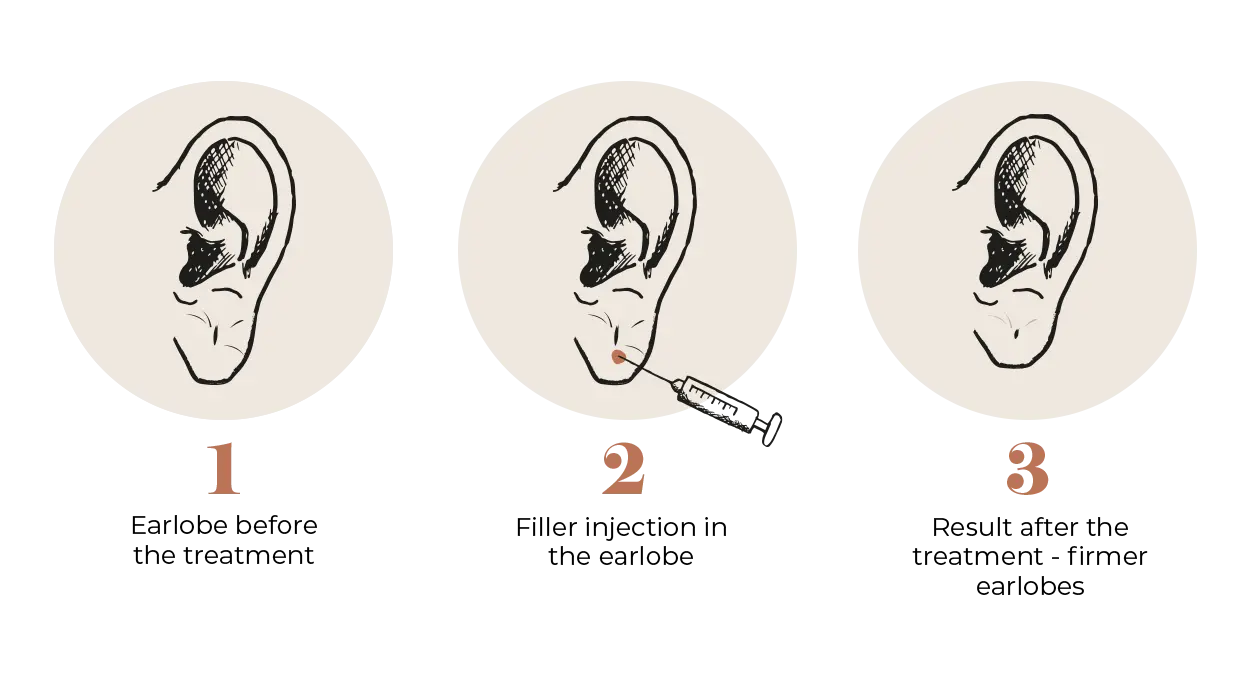 Earlobe Correction
