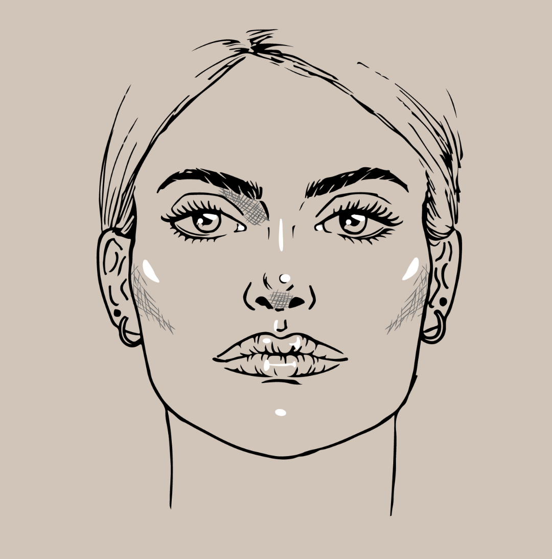 Profhilo Structura: effetto lifting e volume naturale