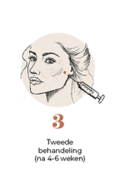 steps-img-{{ loop.index }}