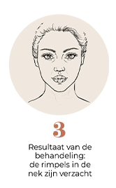 steps-img-{{ loop.index }}