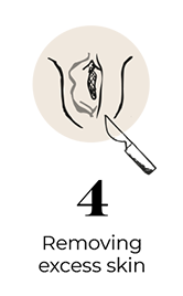 steps-img-{{ loop.index }}