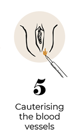 steps-img-{{ loop.index }}