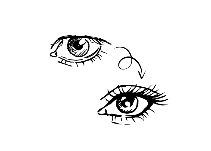 De ooglidcorrectie van Angela: een frisse blik zónder hoofdpijn